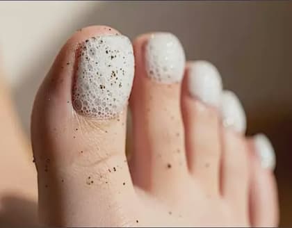 Toenail Fungus Fighters Swear By This 1 Simple Home Trick ...