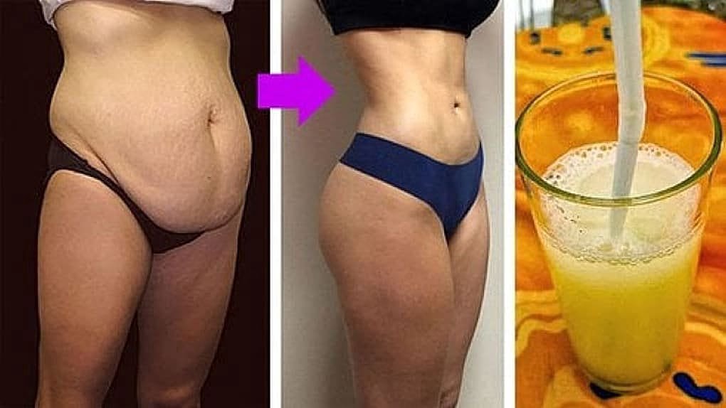 Belly Fats Melts Like A Crazy! -16kg For 2 Week If Take This!
