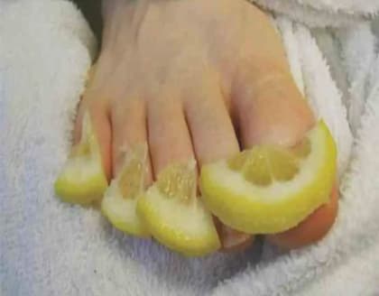 Fungus Fades Fast With This Simple Evening Routine!