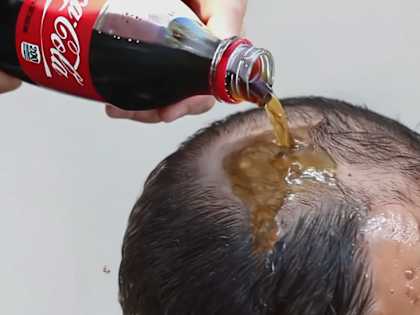Hair Grows Back in 2 Weeks! At Any Stage of Baldness