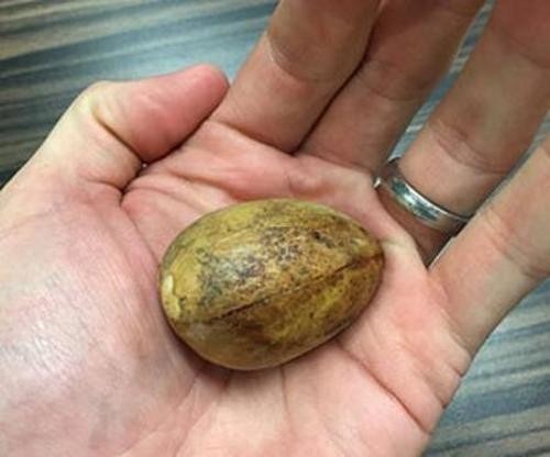 The “killer” of prostatitis and impotence has been found!