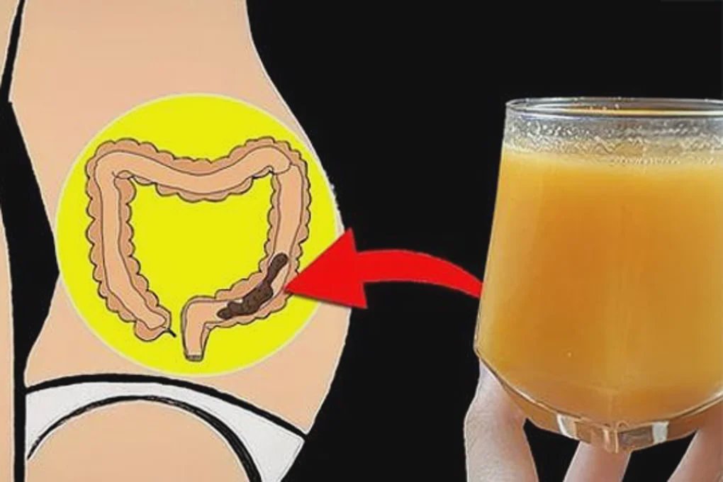 Home Remedy For Constipation That Works In 17 Minutes