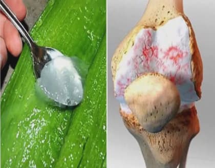 Surgeon: "Enough! If you have hip or knee pain, eliminate it from your diet immediately..."