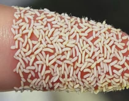 This Trick Kills All Parasites In Your Body Overnight!